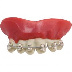  aparato dental para dentadura postiza